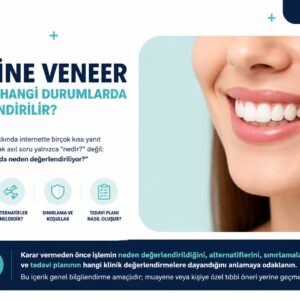 Lamine veneer nedir ve hangi durumlarda değerlendirilir?