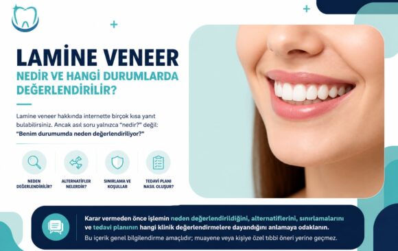 editor-ai-visual-carry-c056bb1f6a5b7c5fbea12d9a87dfbddf68918f27 Lamine veneer nedir ve hangi durumlarda değerlendirilir?