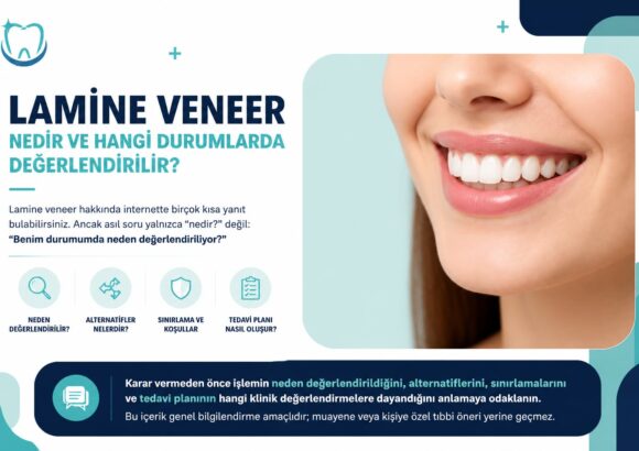 Lamine veneer nedir ve hangi durumlarda değerlendirilir?