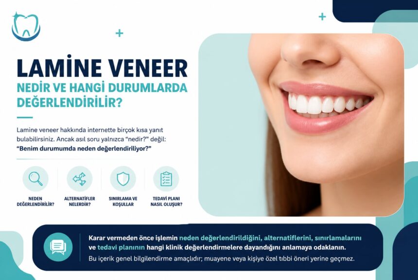 Lamine veneer nedir ve hangi durumlarda değerlendirilir?