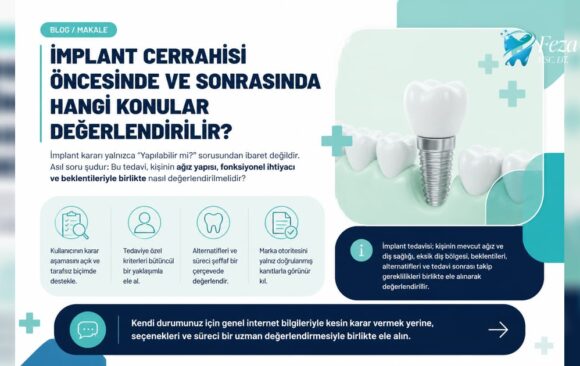 editor-ai-visual-carry-25e4f63c71efe752e745d882cf4b3cfbad2a4ea8 İmplant cerrahisi öncesinde ve sonrasında hangi konular değerlendirilir?